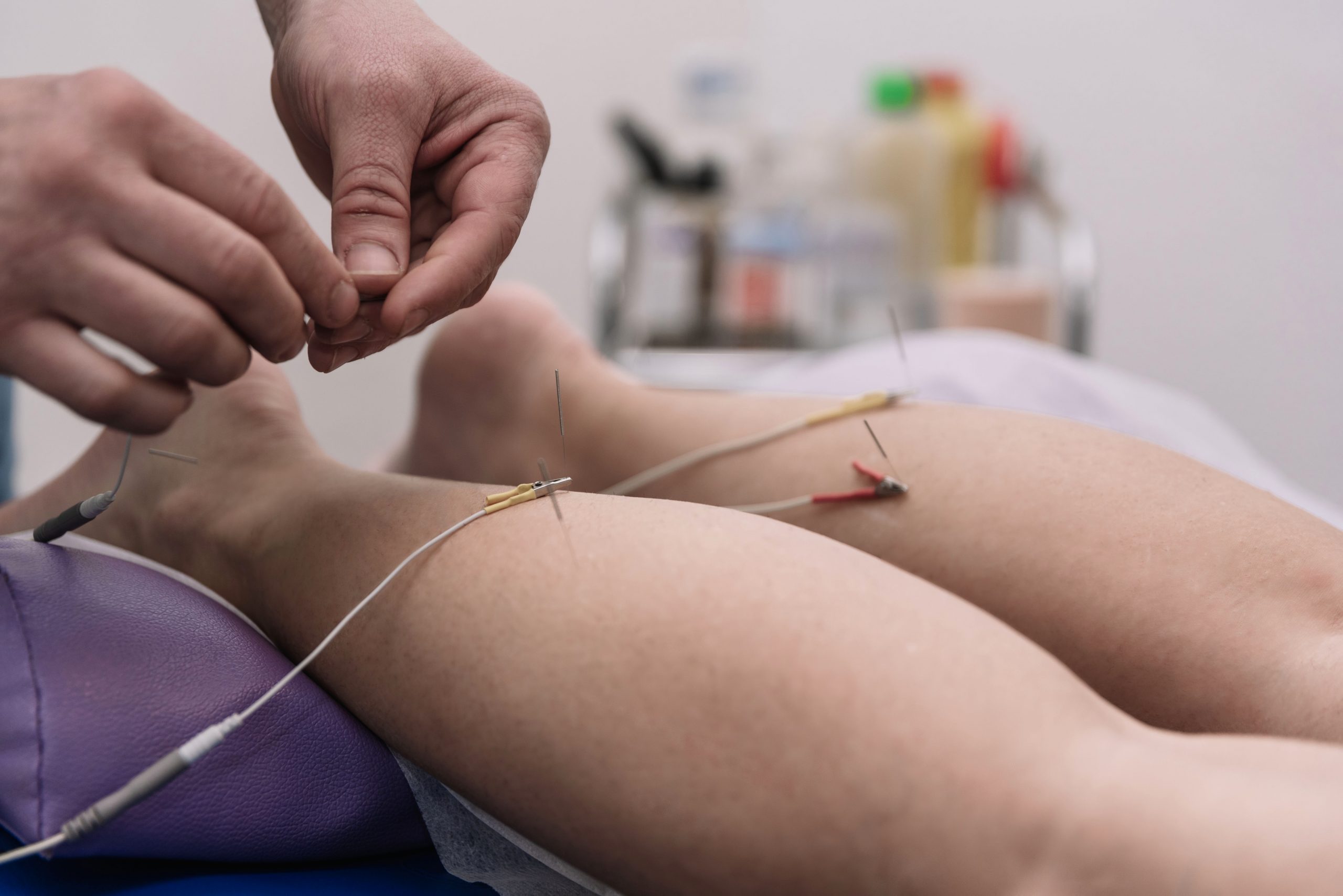 Fisioterapia invasiva