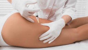 Mesoterapia Corporal Dermatofuncional