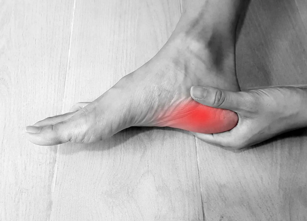 Dolor en la planta del pie: causas más allá de la fascitis