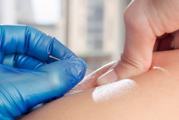 Fisioterapia invasiva: qué técnicas incluye y cuándo se utiliza