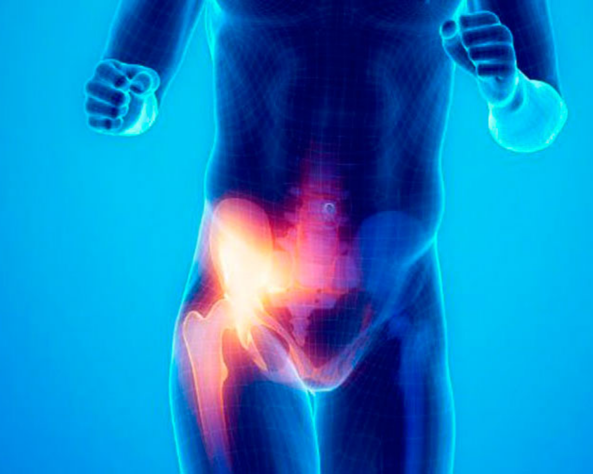 Pubalgia: causas del dolor en la ingle al hacer deporte