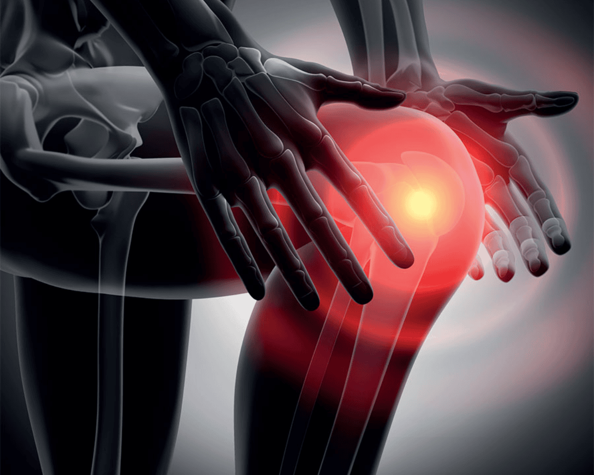 Tendinopatía rotuliana: dolor de rodilla al saltar o correr